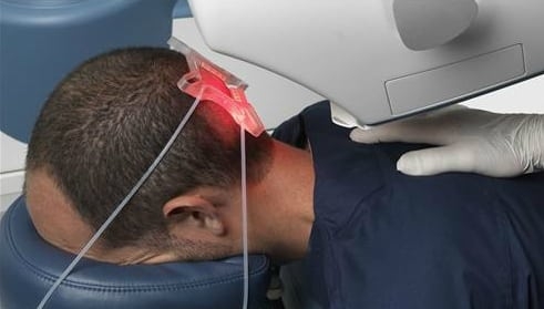 Understanding Robotic Hair Transplant Cost in Dubai