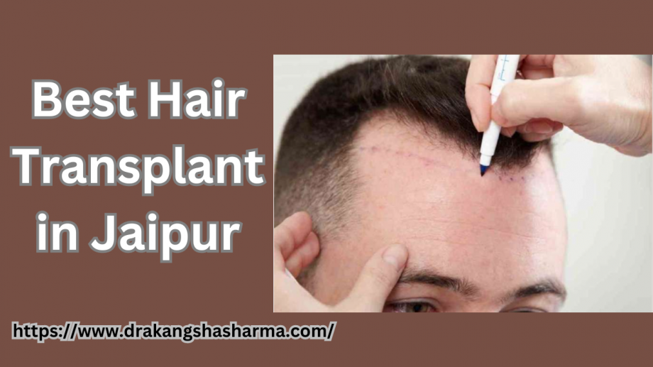 What is the Healing Time For Hair Transplant?