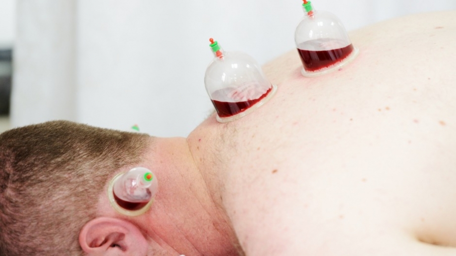 What’s Included in the Cost of Hijama in Dubai