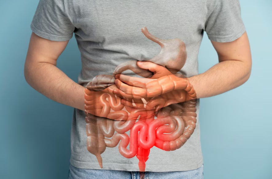 Chronic Constipation: When to See a Specialist