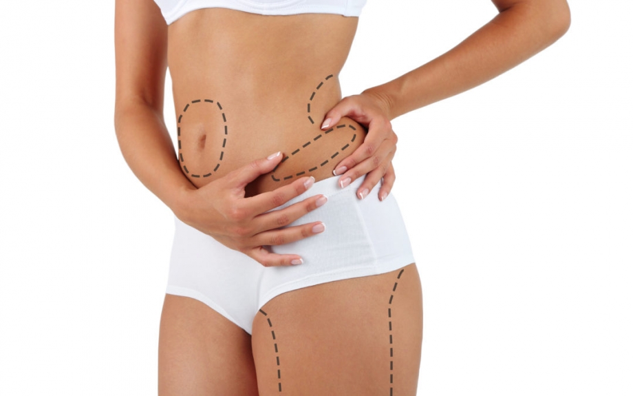 Transform Your Body: The Ease of Liposuction in Dubai