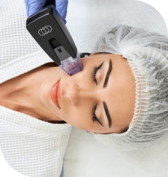 Morpheus 8 Treatment in Dubai: Achieve Smooth Skin and Wrinkle Reduction