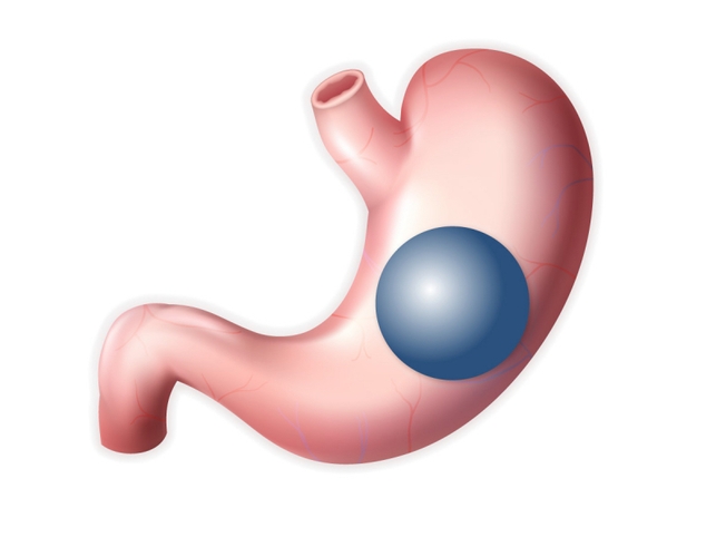 Discover the Best Gastric Balloon Placement Services in Dubai