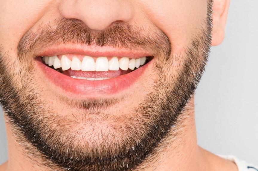 Transform Your Smile: Exploring Dental Veneer Costs in Dubai