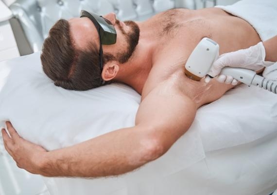 Common Concerns Men Have About Laser Hair Removal in Dubai