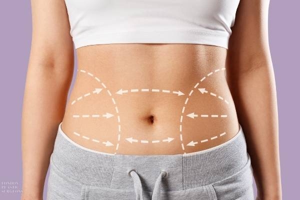 What Should You Know Before Scheduling Liposuction Surgery in Dubai?