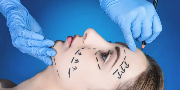 Plastic Surgery in South Delhi: Discover a New You with Dr. Anshumali Misra