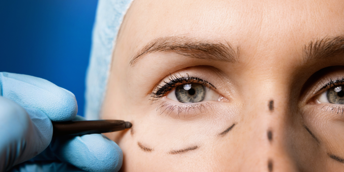 Transform Your Look with Expert Plastic Surgery in South Delhi: Your Journey to Confidence Begins Here