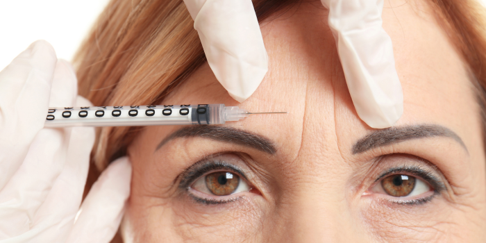 Best Botox treatment in Delhi for wrinkles and hyperhidrosis