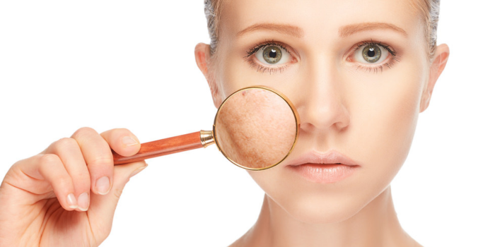 Expert Advice on Pigmentation Treatment in Delhi: Your Ultimate Guide