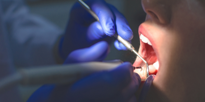Your Trusted Dentist in Gurgaon for a Healthy, Confident Smile