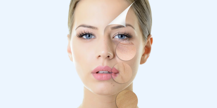 Everything You Need to Know About Profhilo Treatment in Delhi