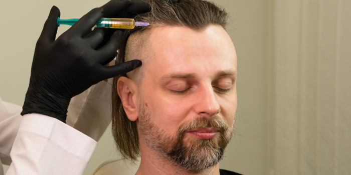 PRP Treatment For Face: Cost, Benefits & Procedure