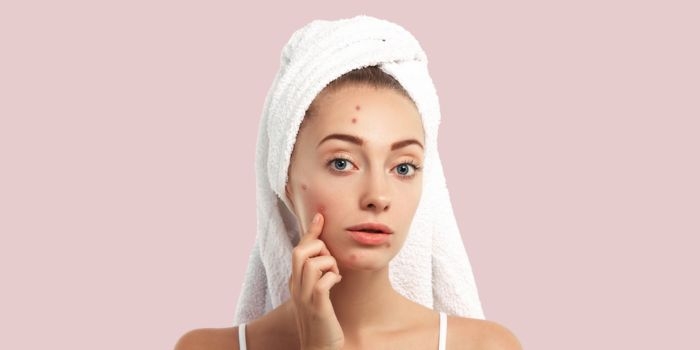 Effective Acne Treatment in Delhi: Clear Skin Starts at the Right Clinic