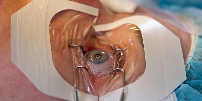 How Long Is the Healing Process for the Cornea Post-Surgery?