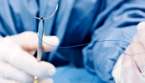 Dental Suture Market Growth and Strategic Outlook 2025-2032