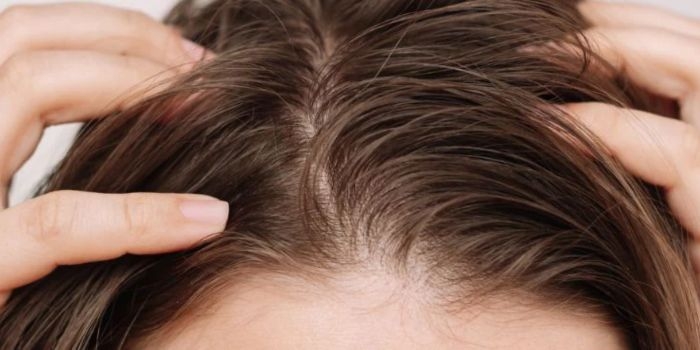 Monsoon Hair Care Secrets: Keep Your Scalp Clean and Hair Shiny