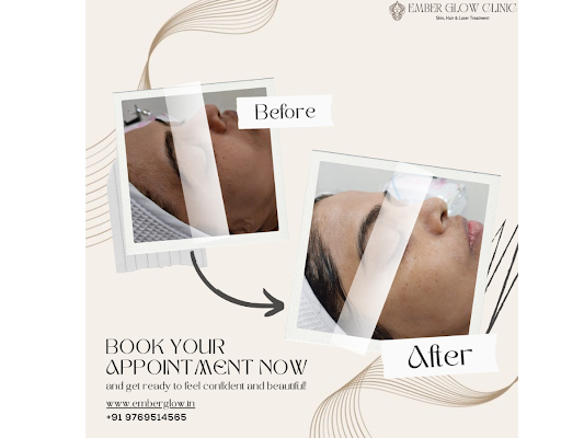 Baldness Treatment In Manpada