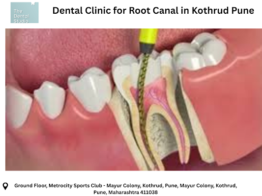 Best Dentist in Kothrud Pune - Your Trusted Dental Studio