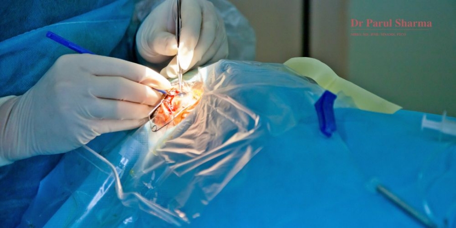 Cataract Surgery in Gurgaon: Restore Your Vision with Expert Care