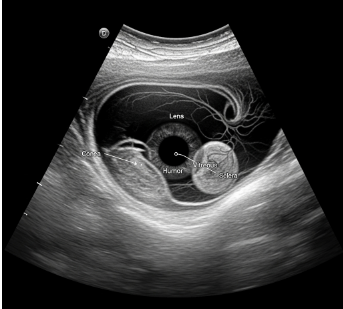 Ophthalmic Ultrasound Market Investment Trends and Future Roadmap by 2032
