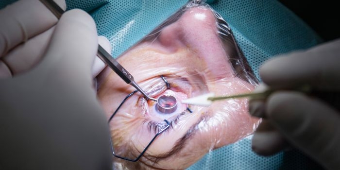 Eye Surgeon in Gurgaon - Caring for Your Vision with Skill and Compassion