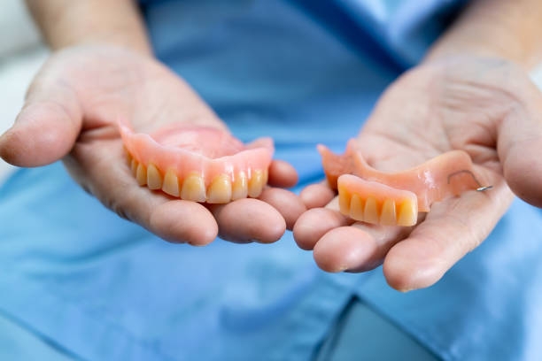 Full vs. Partial Dentures in Gaithersburg: Making the Right Choice