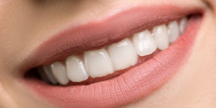 Teeth Whitening in Gurgaon – Brighten Your Smile at Dr khullar dental clinic