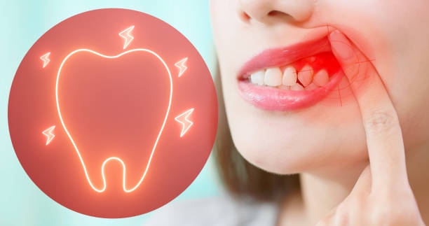 Wisdom Teeth Removal: Signs You Need Surgery