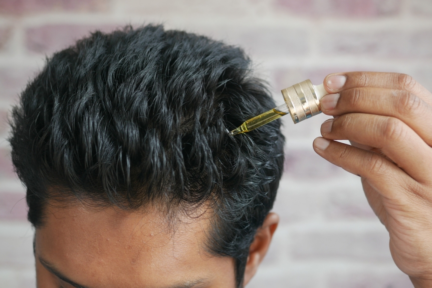 Hair Oiling After Hair Transplant: Essential Guide for Healthy Growth