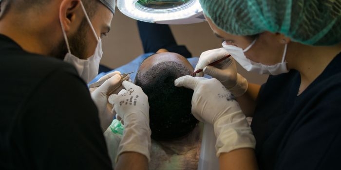 Hair Transplant in Delhi: Restore Your Confidence with Hairbud