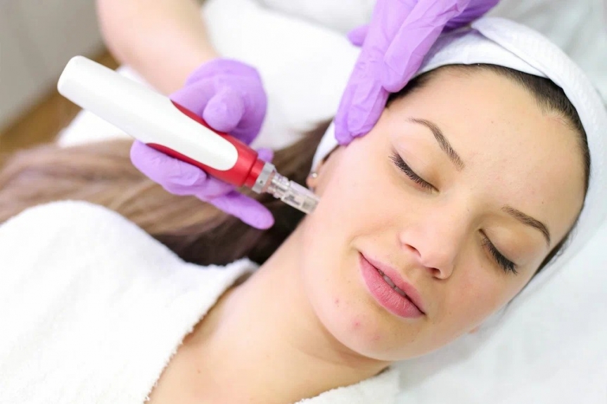 Redefining Wellness: How Microneedling and GLP-1 Therapies Work Together for a Healthier, More Confident You