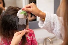 San Antonio Lice Removal Experts – Fast, Safe Treatment by Lice Care Solutions