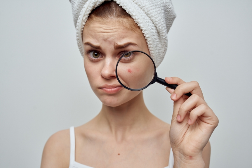 Acne Treatments: A Dermatologist’s Guide