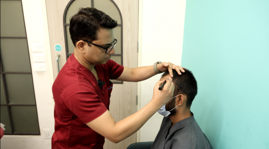 Latest Techniques Used by Leading Hair Transplant Clinic in Delhi