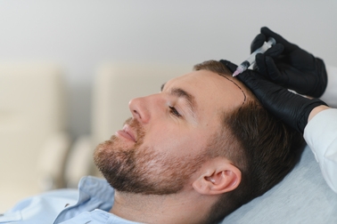 A man receiving PRP hair treatment on his scalp at a clinic, showing a close-up of a medical professional injecting platelet-rich plasma to promote hair growth.
