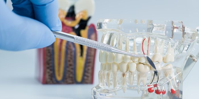 Endodontic Courses for General Dentists in Delhi - Enhance Your RCT Skills with Dr Khullar Dental Academy