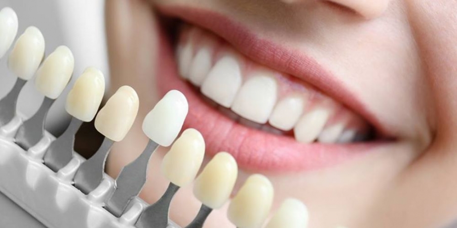 Cosmetic Dentist in Gurgaon: Top Clinics for Teeth Whitening & Veneers