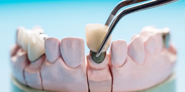 Prosthodontics Courses in Delhi: Build a Strong Career with Dr Khullar Dental Academy