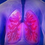 lung cancer early signs